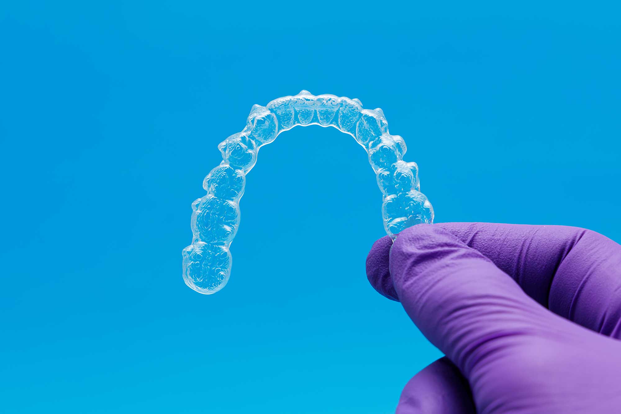 Invisalign service